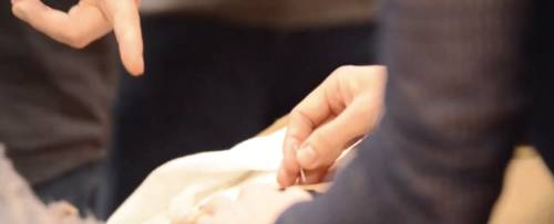 Acupuncture