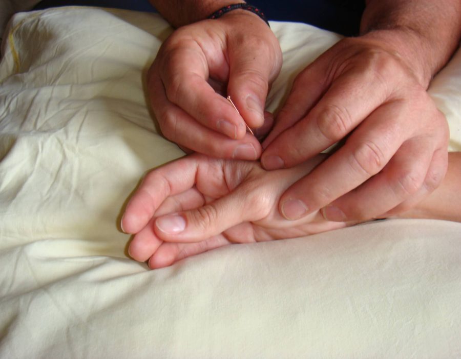 Formation acupuncture Paris